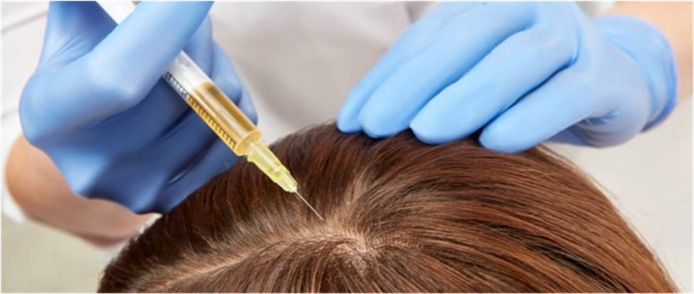 Plasma Hair Restoration PRP - Amate Cosmetic Surgery & Spa